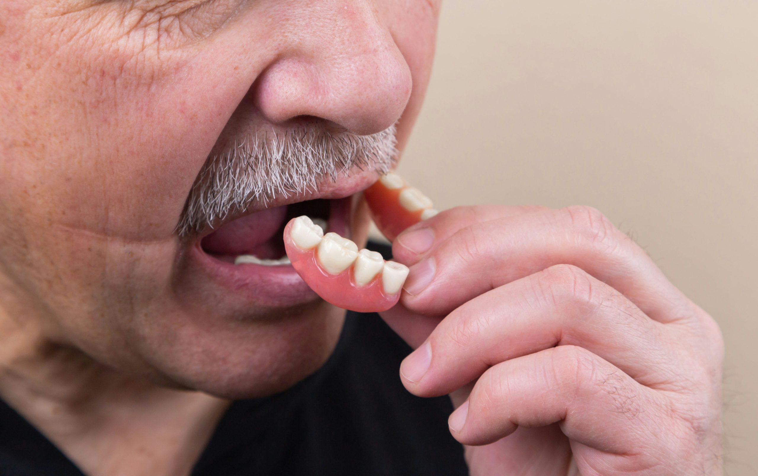 Dentures and Oral Health