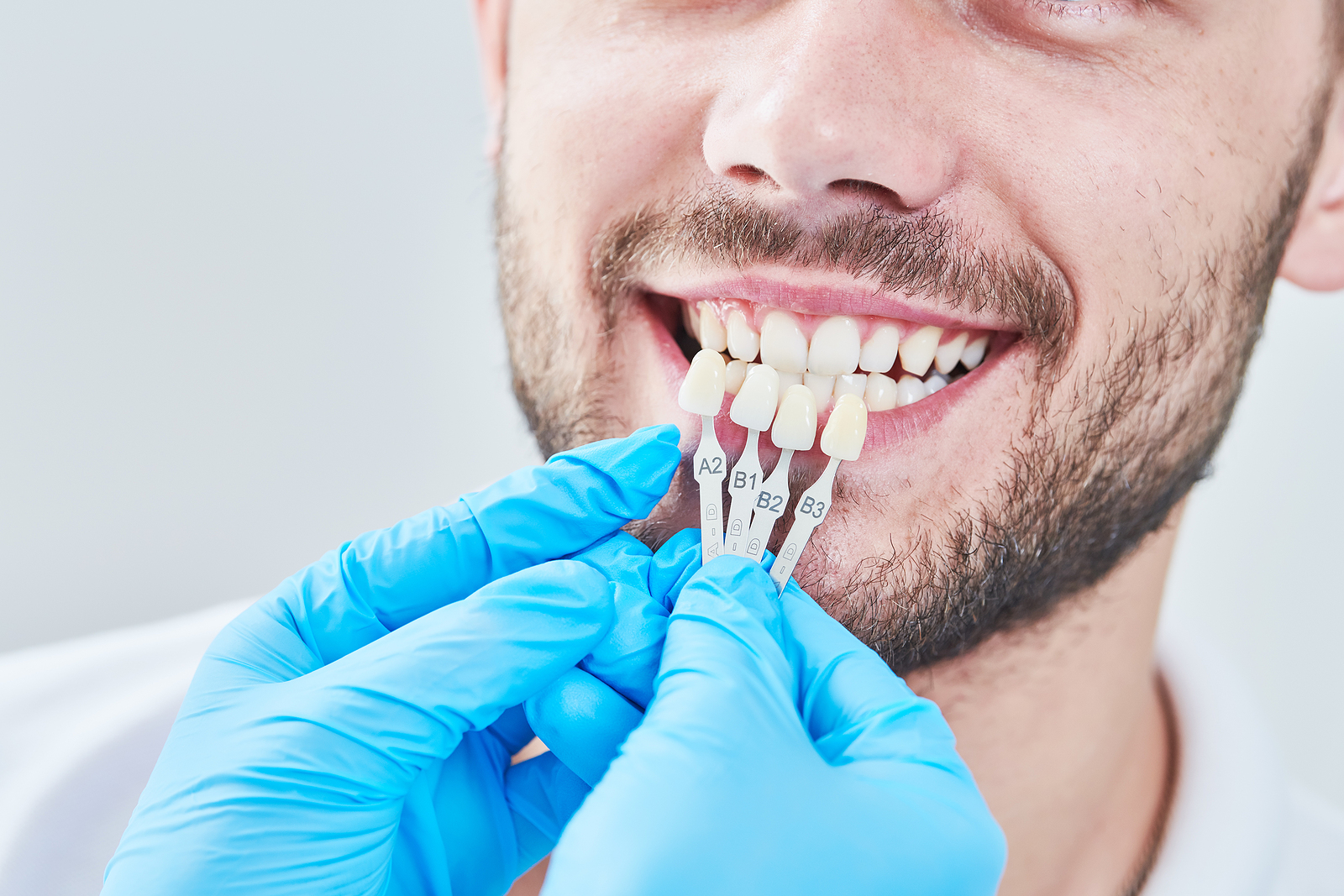Comprehensive Full Mouth Reconstruction in Pasadena, TX: Restoring Your Smile and Oral Health